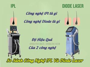so-sanh-cong-nghe-triet-long-IPL-diode-laser