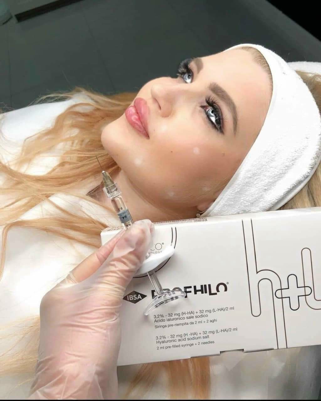 10 cau hoi ve tiem profhilo la gi truoc khi quyet dinh tiem profhilo 65b48fc9dc52a