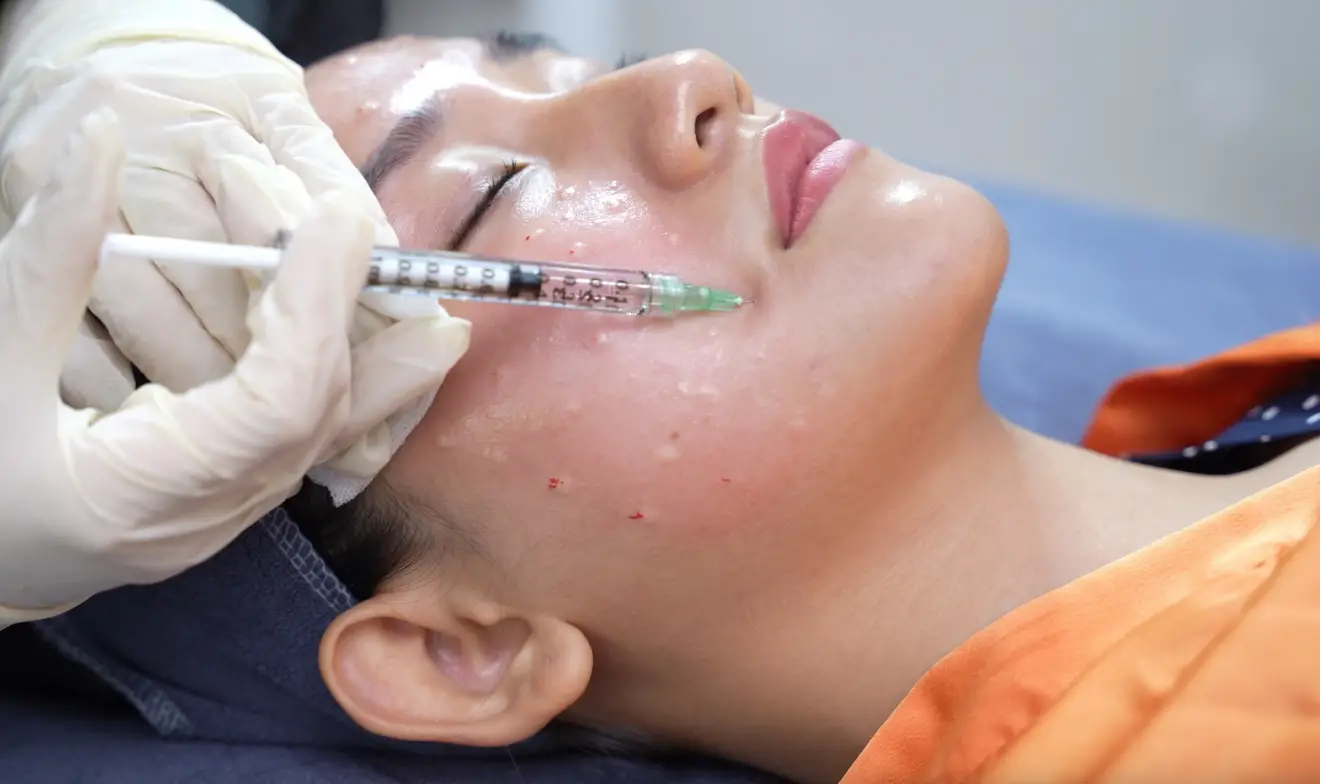 cham soc da sau tiem meso cach thuc hien va cac loi khuyen 666e66299f9e6