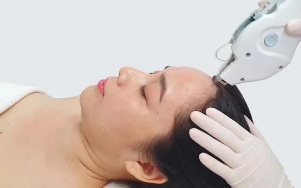 Meso không kim là gì