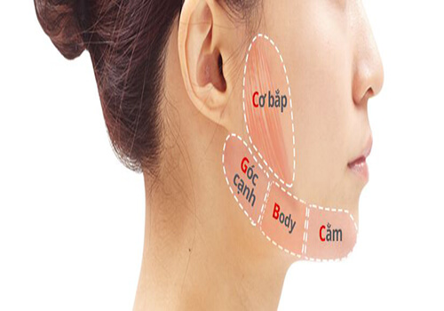 Tiêm Gọn Hàm Một Giải Pháp Hiện Đại cho Khuôn Mặt