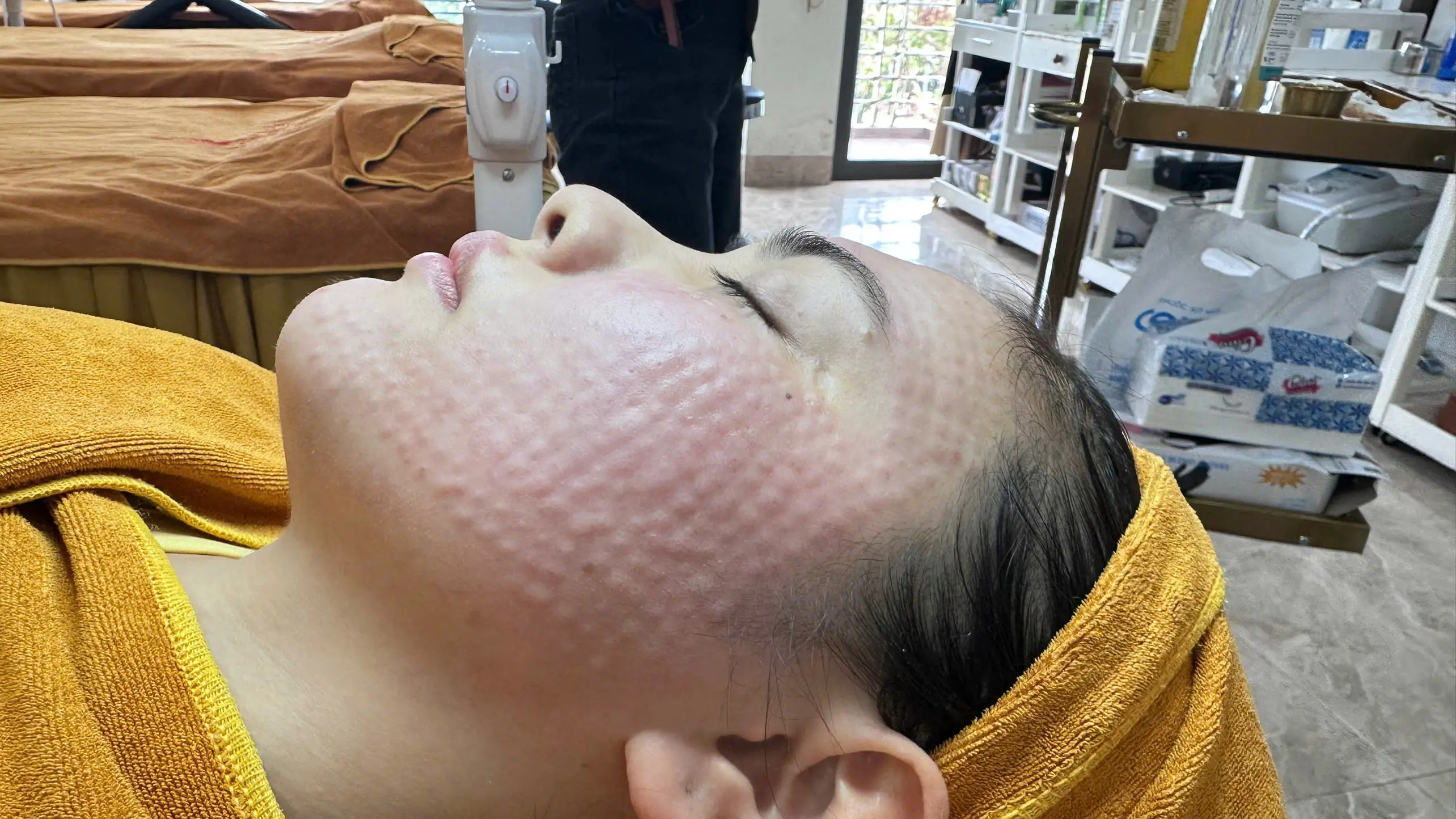 cay meso cang bong 672ecc1175504