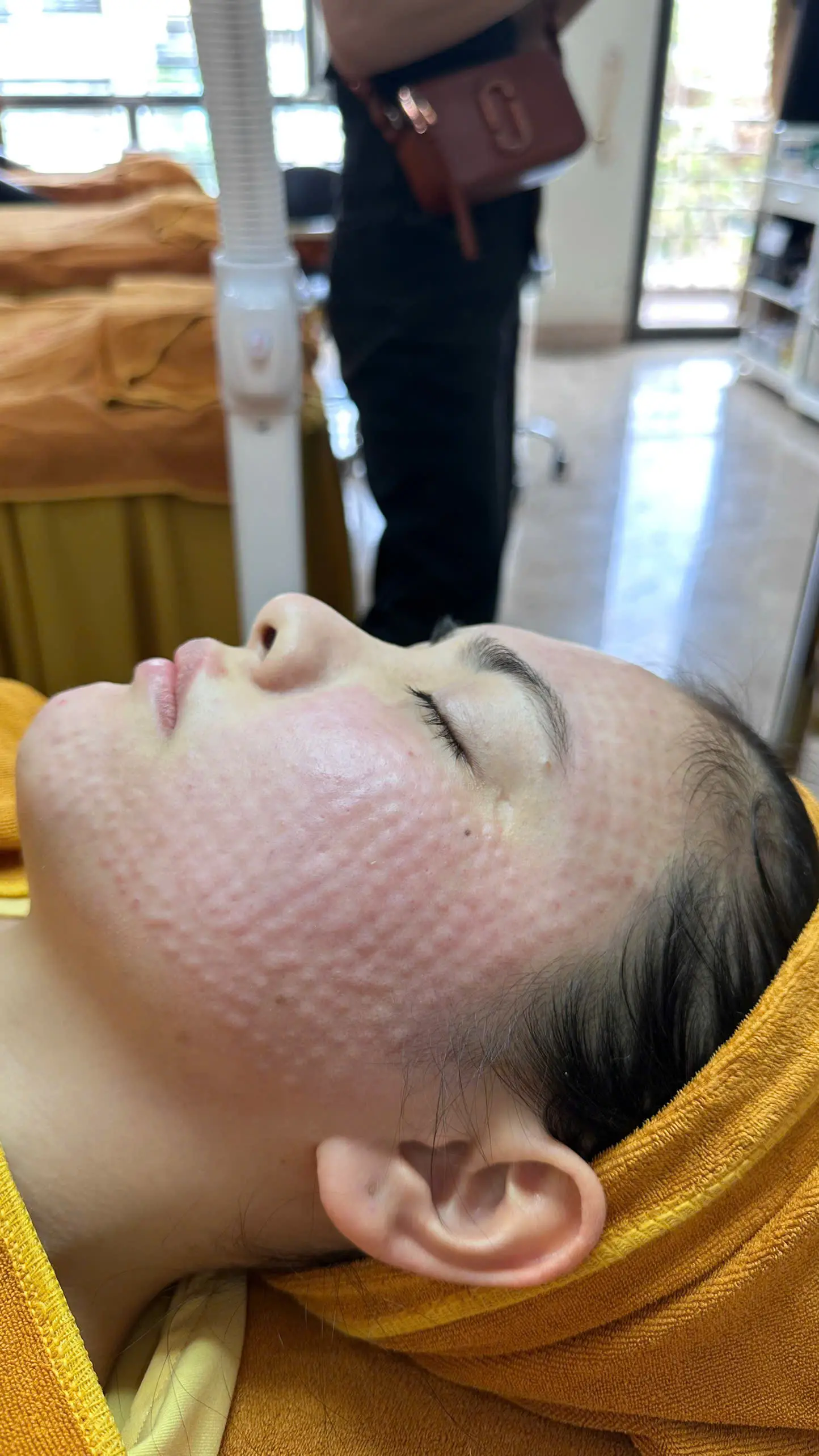 gia tiem meso cang bong 6729b031b55c8