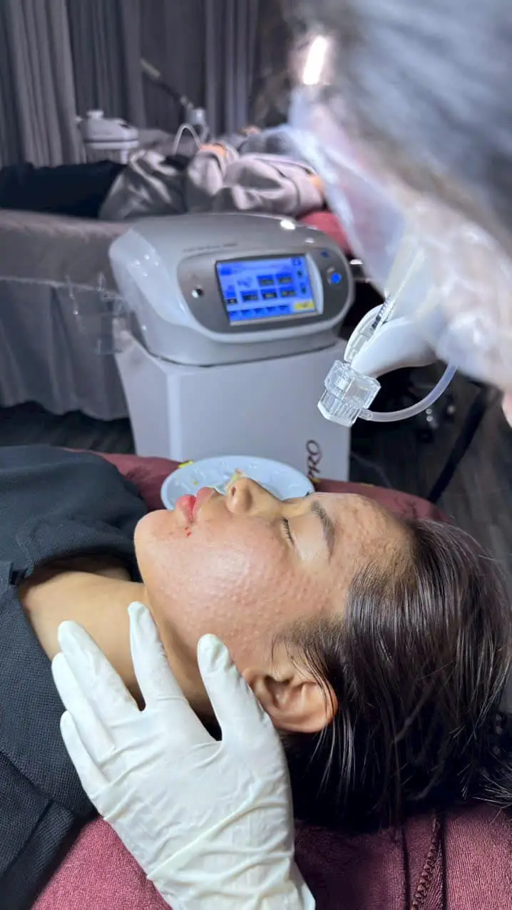 kham pha cong nghe cang bong da meso tien tien bi quyet so huu lan da cang bong tre trung 672ecf5756dbb