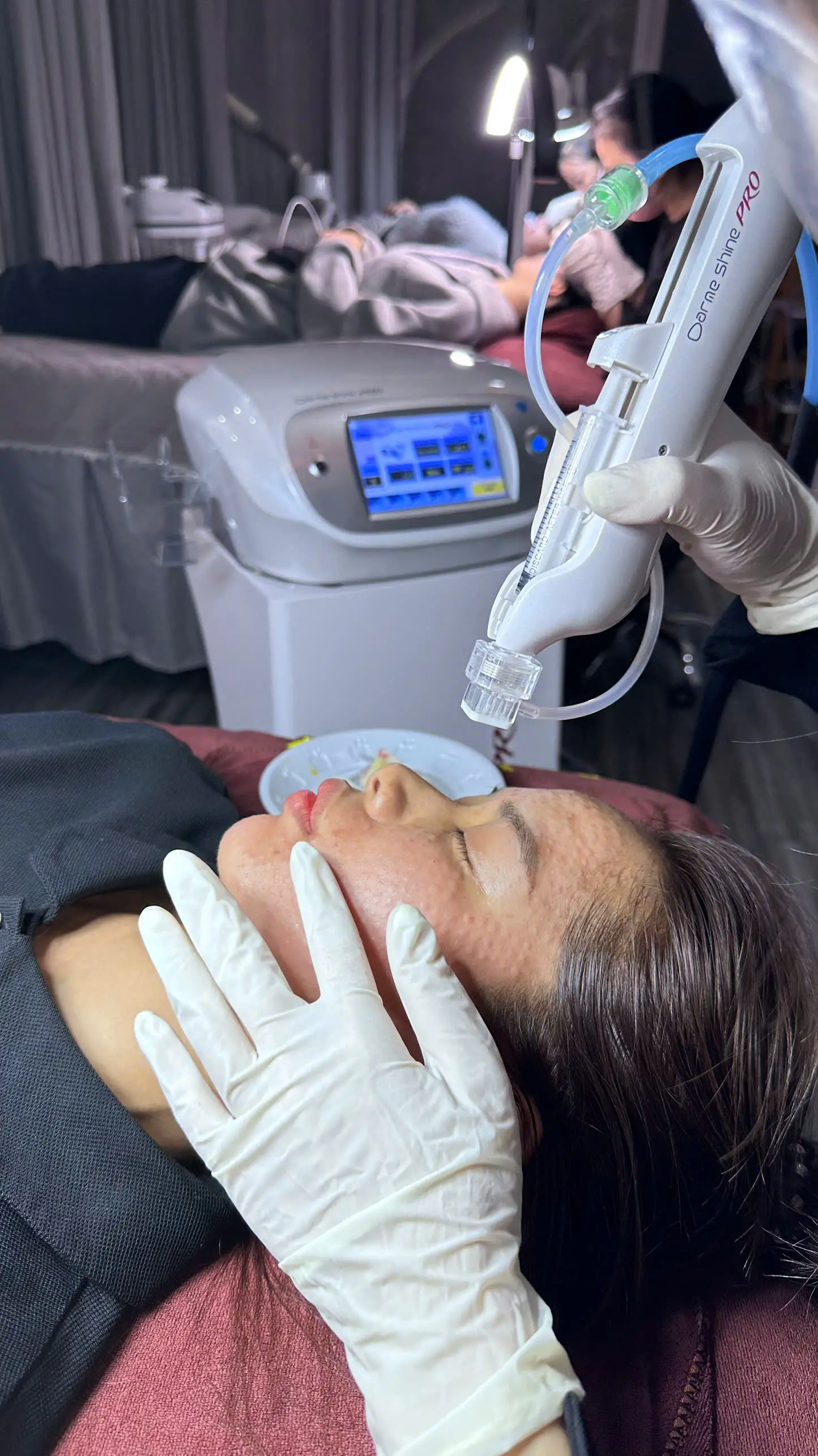 phuong phap meso cang bong 6729aeb3cd3a3