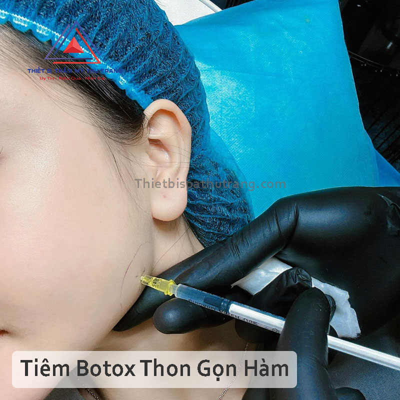 tiem botox gon ham co duoc nam nghieng khong 672863c44a6d0