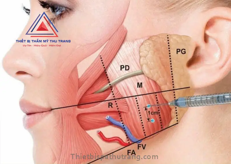 tiem botox gon ham giu duoc bao lau 6728492736ae4