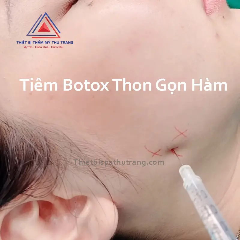 tiem botox gon ham lua chon hoan hao cho guong mat thon gon 672840c0e66fa