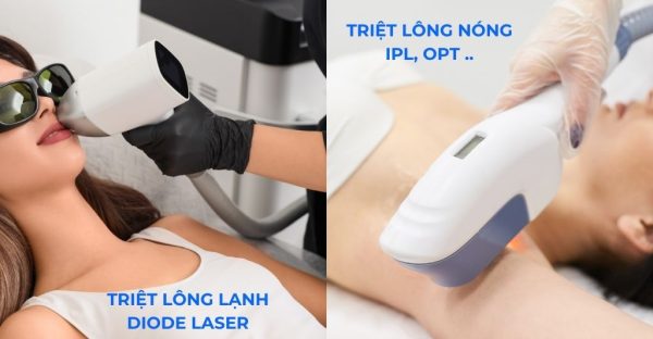 So sánh triệt lông nóng và lạnh